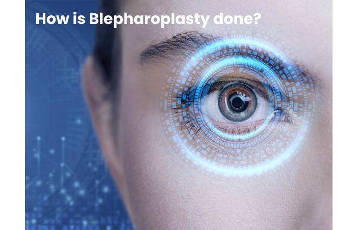 How is Blepharoplasty done?