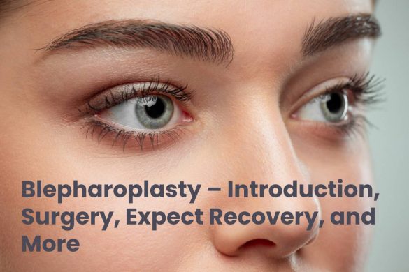 Blepharoplasty – Introduction, Surgery, Expect Recovery, and More