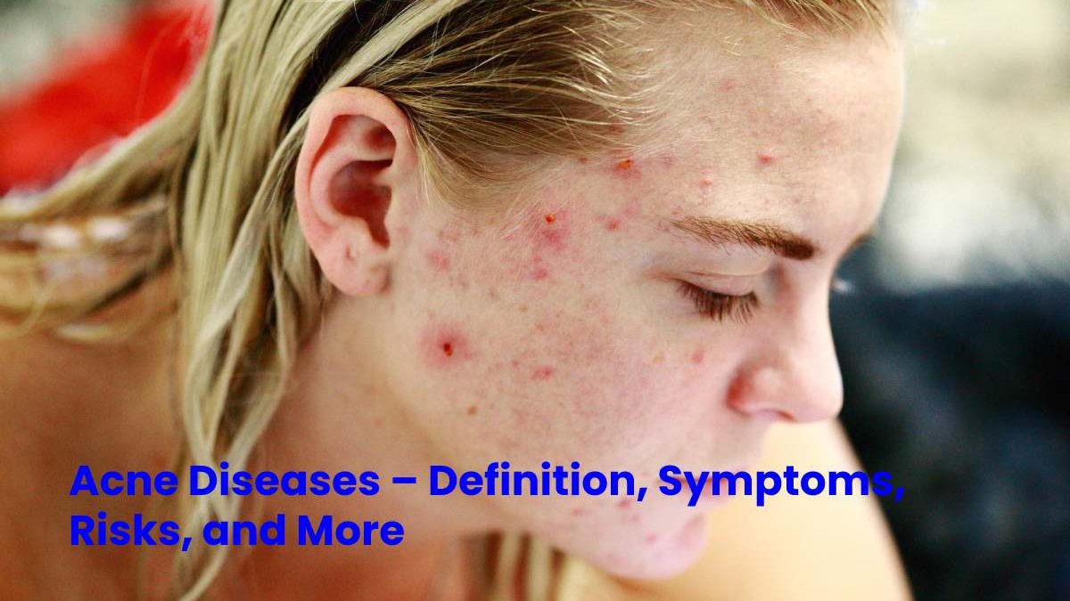 Acne Diseases – Definition, Symptoms, Risks, and More