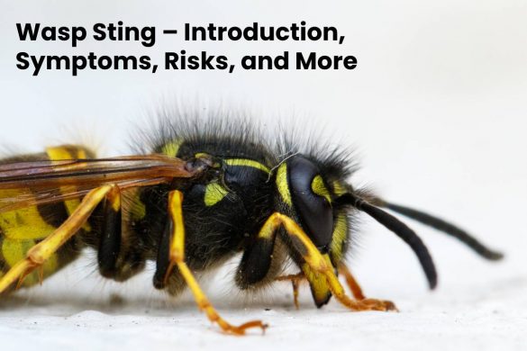 Wasp Sting – Introduction, Symptoms, Risks, and More