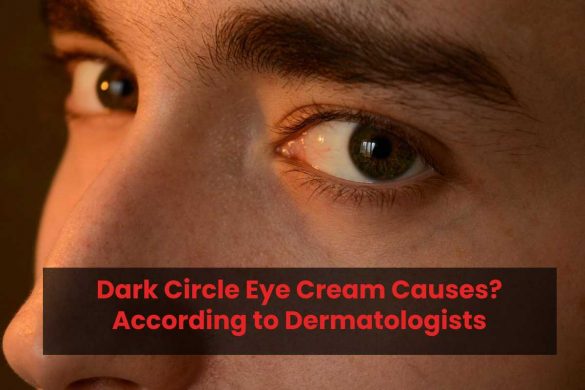 Dark Circle Eye Cream Causes? According to Dermatologists