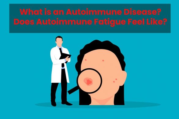 What is an Autoimmune Disease? Does Autoimmune Fatigue Feel Like?