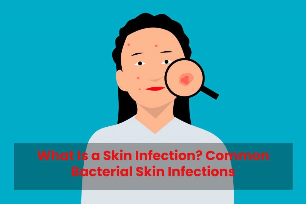 What Is a Skin Infection? Common Bacterial Skin Infections