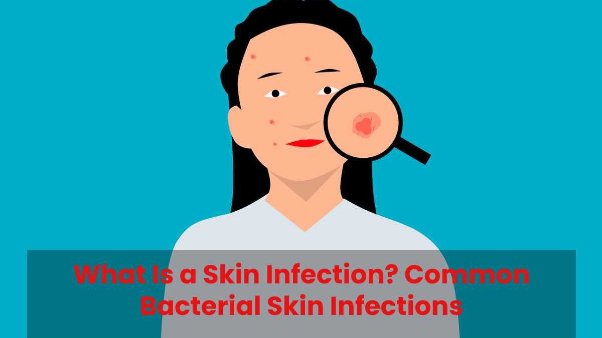 What Is a Skin Infection? Common Bacterial Skin Infections