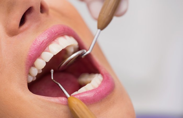 Oral Dental Appliances - Sleep Houston