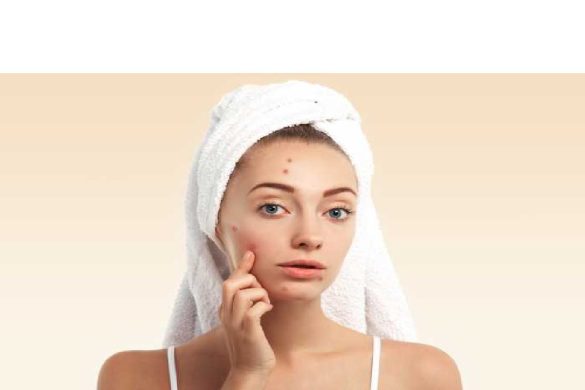 Acne Diseases – Definition, Symptoms, Risks, and More